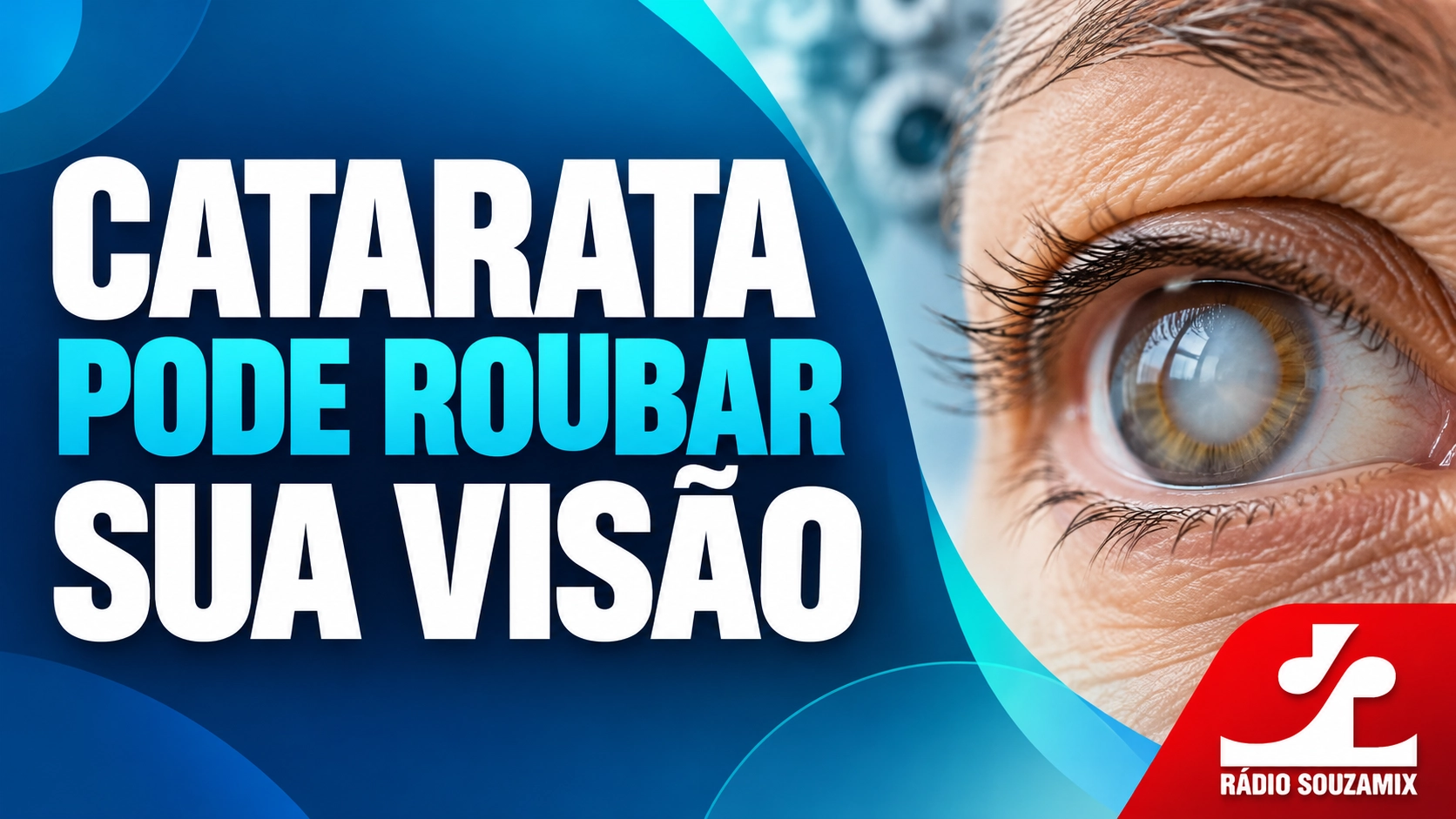Catarata tem cura? Saiba tudo sobre sintomas, causas, cirurgia e tratamento pelo SUS