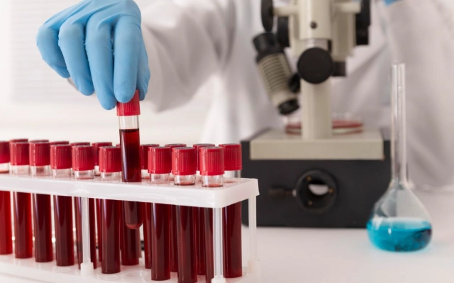 Hospital começa a oferecer no Brasil exame de sangue que busca sinais de mais de 50 tipos de câncer